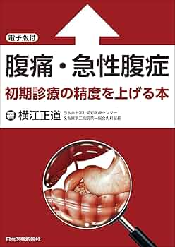 【moconocotenさん用】急性腹症/腹痛の「なぜ？」/人工呼吸管理 moconocotenさん用】急性腹症/腹痛の「なぜ？」/人工呼吸管理